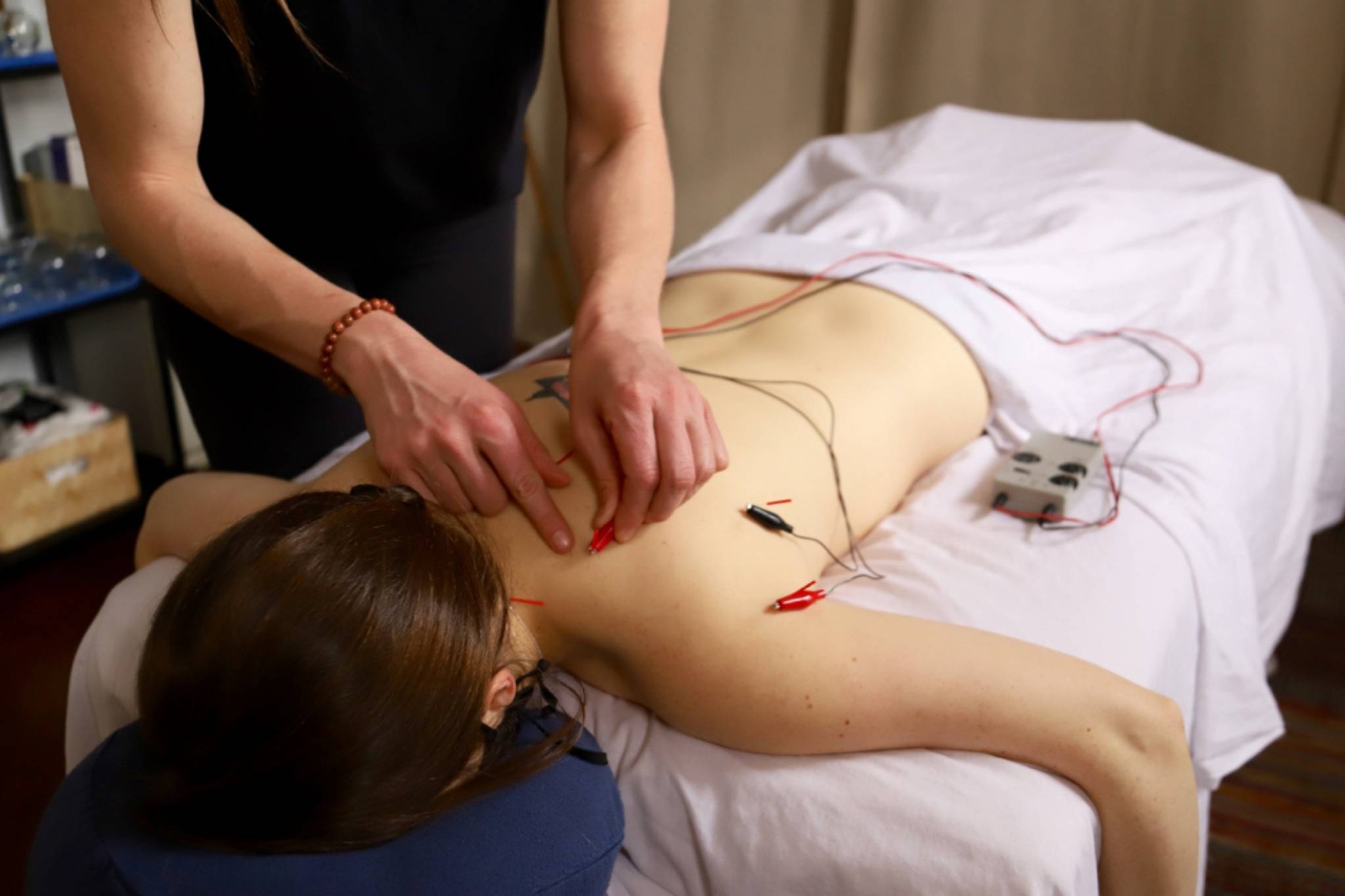 girl getting dry needling in back with e-stim