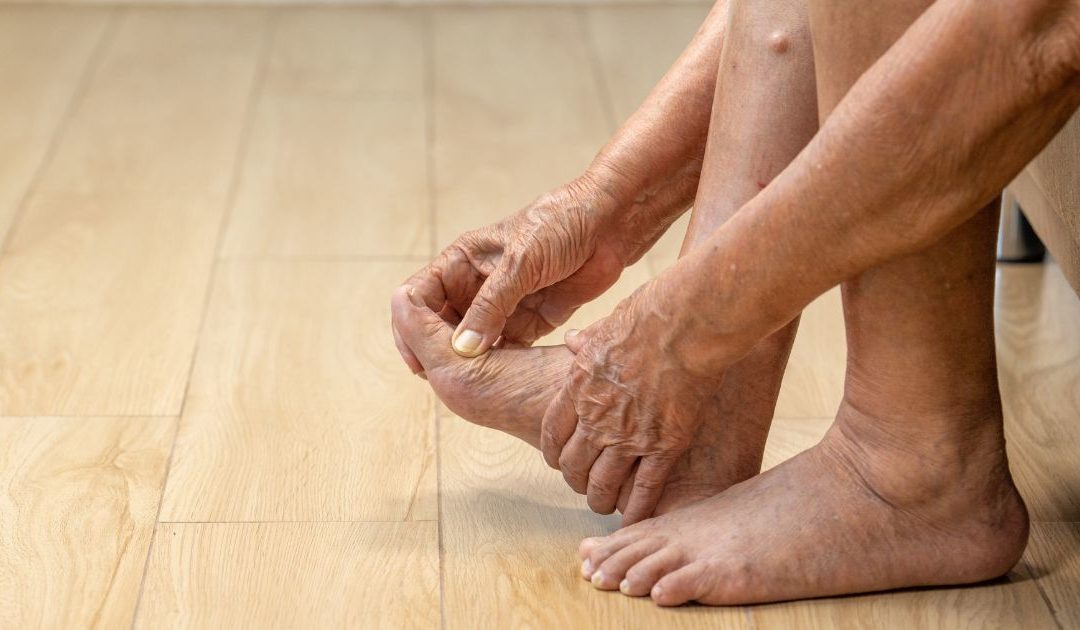 Treating Gout with Massage