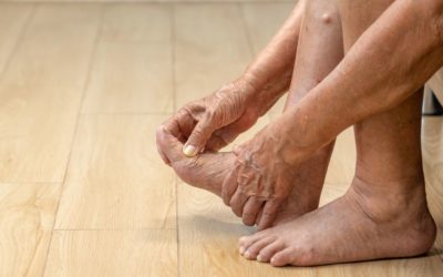 Treating Gout with Massage