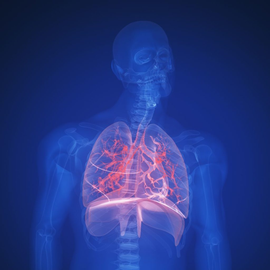 lungs highlighted in red on xray