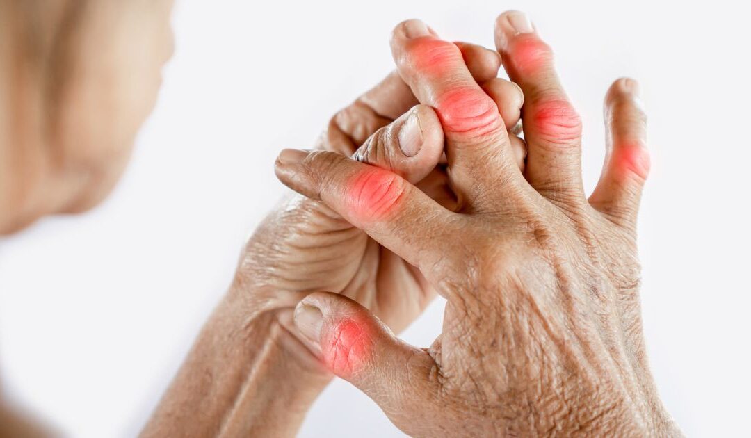 Can Massage Therapy Help with Arthritis Pain?